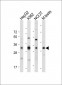 LIN28B Antibody (Center)